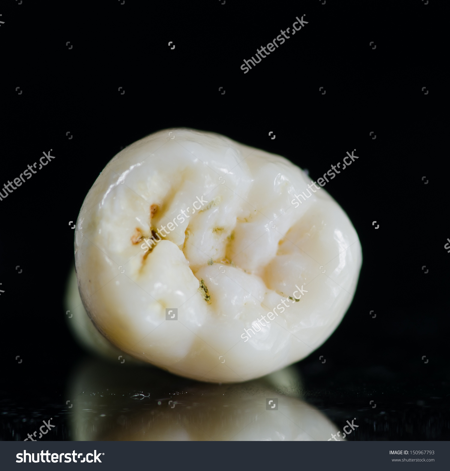Occlusal Surface Of Tooth